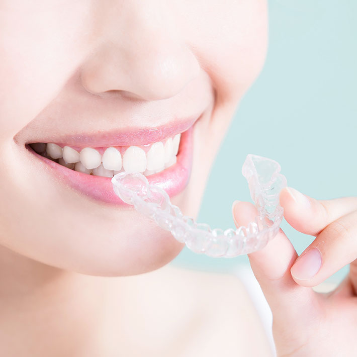 当院の矯正へのこだわり