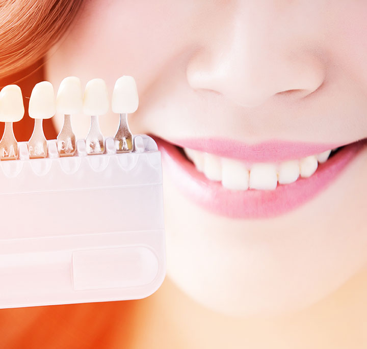 美しさと機能性を両立する審美的治療