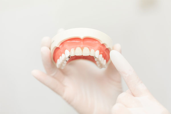 「まるで自分の歯のような使い心地」──ナチュラルDの入れ歯治療